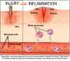 INFLAMMATION.jpg INFLAMMATION.jpg