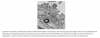 exosome.png exosome.png