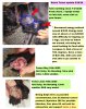 Rasin tumor 2.jpg Rasin tumor 2.jpg